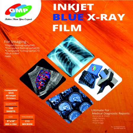 GMP Medical X- Ray Inkjet Film (8 x 10) Blue Medical Film for Inkjet Printing (X Ray, CT, CR, MRI, Radiology etc), compatible with Canon, Epson Printers-100 SHEET
