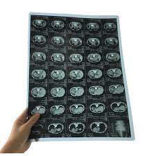 GMP Medical Thermal X-ray Dry Film FUJIFILM Drypix 1000 2000 3000 3500