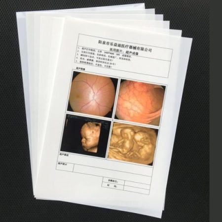 GMP White Dry Hospital Use Inkjet Medical High Quality X-ray Film Ultrasound